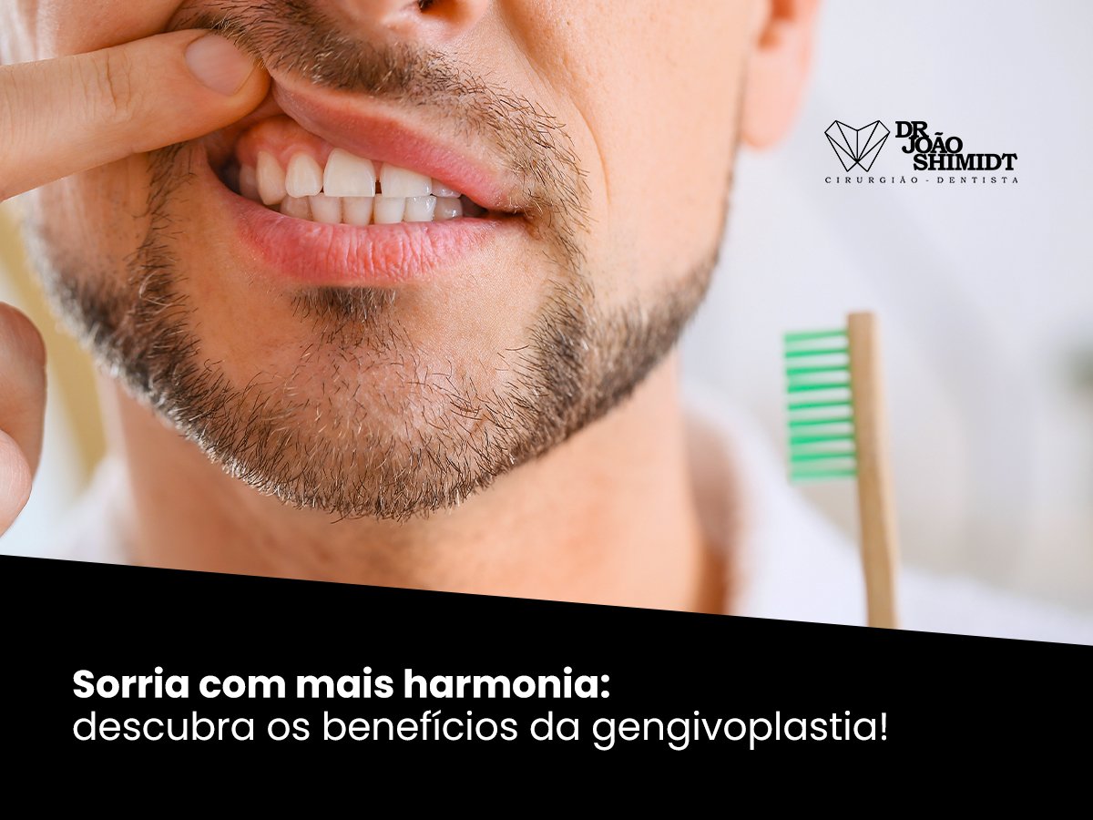 Sorria com mais harmonia: descubra os benefícios da gengivoplastia