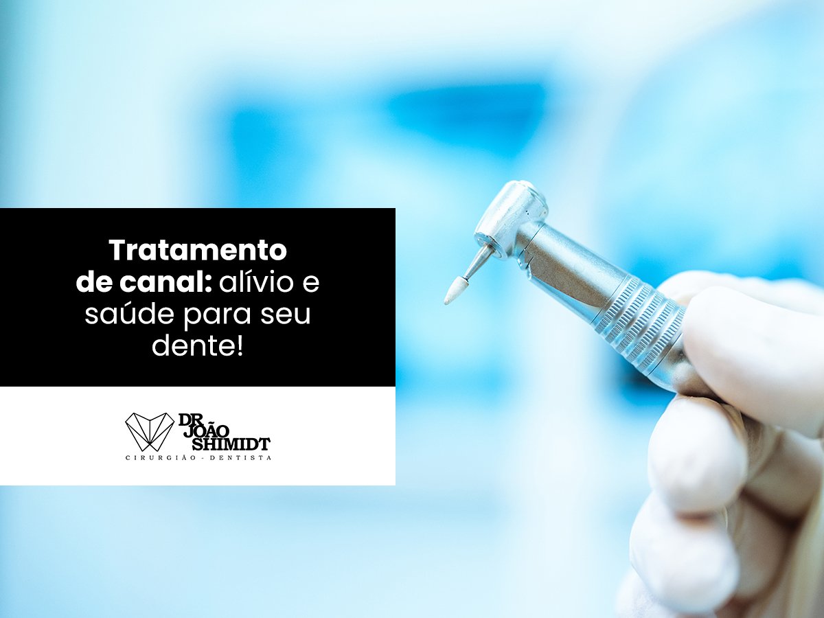 Tratamento de canal: alívio e saúde para seu dente!