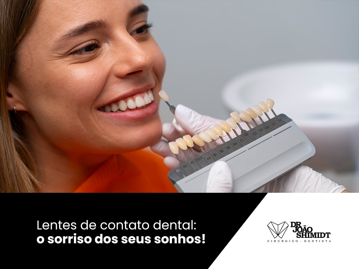 Lentes de contato dental: o sorriso dos seus sonhos!