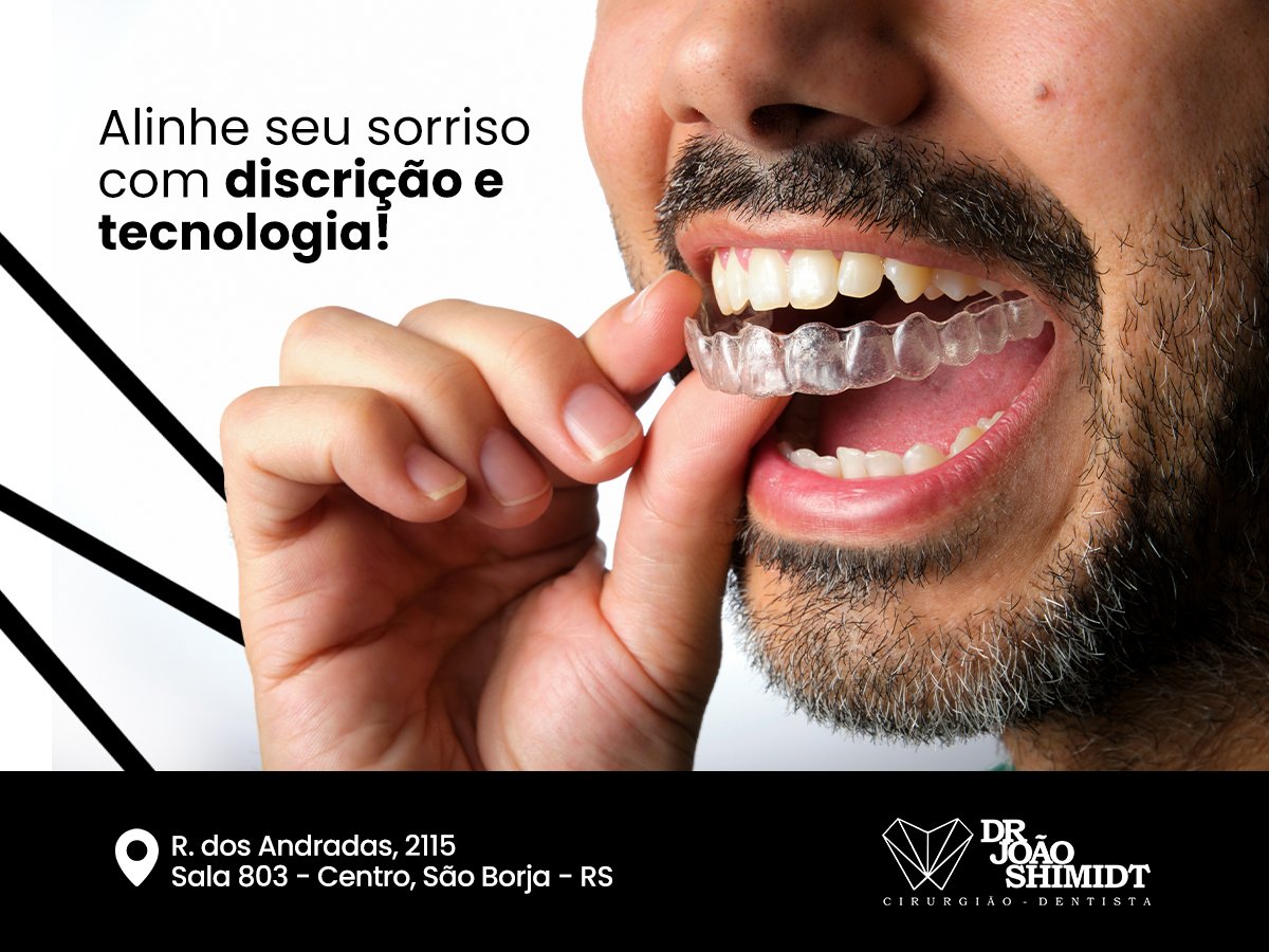 Alinhe seu sorriso com discrição e tecnologia!