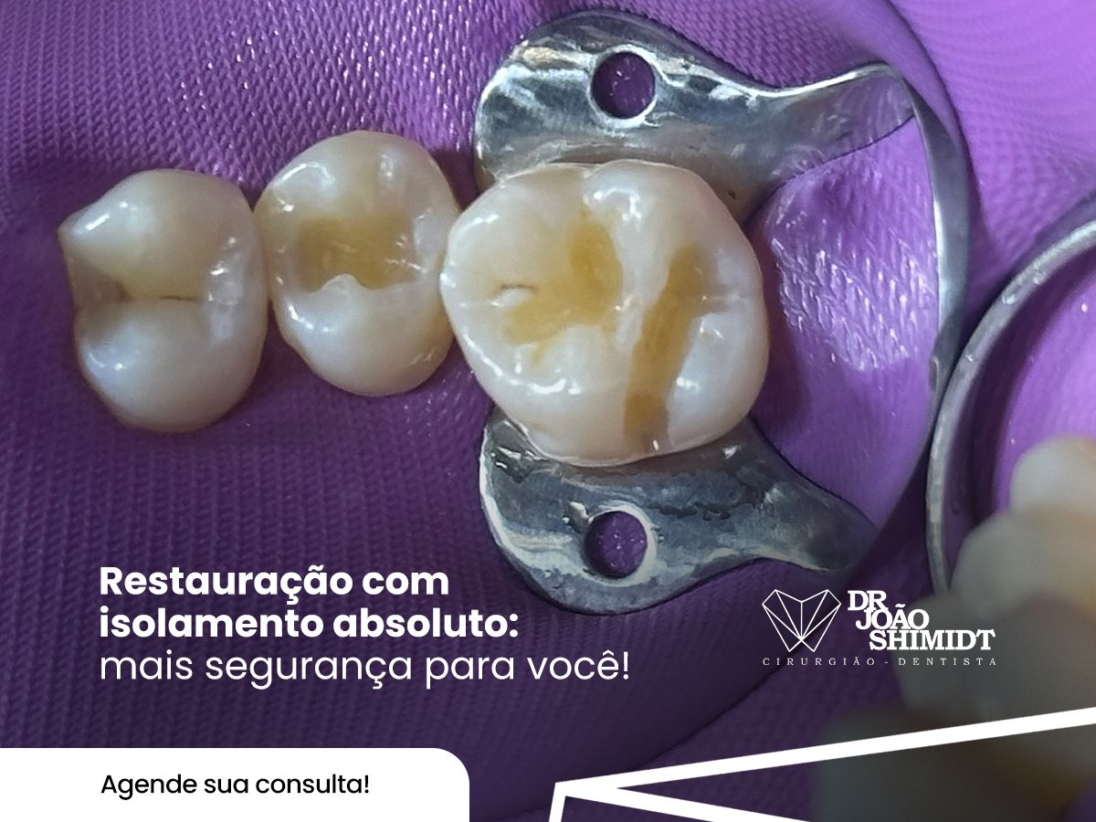 Restauração com isolamento absoluto: mais segurança para você!